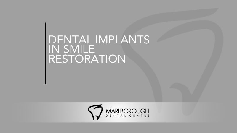 Dental Implants in Smile Restoration